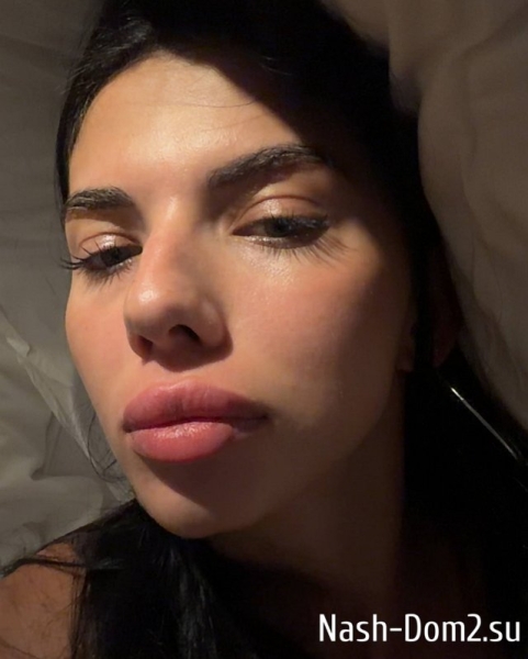 Ирина Пингвинова: Я упала с байка Ирина Пингвинова: Я упала с байка