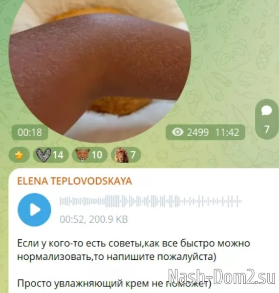 Отдых в Таиланде плохо сказался на здоровье Елены Тепловодской Отдых в Таиланде плохо сказался на здоровье Елены Тепловодской