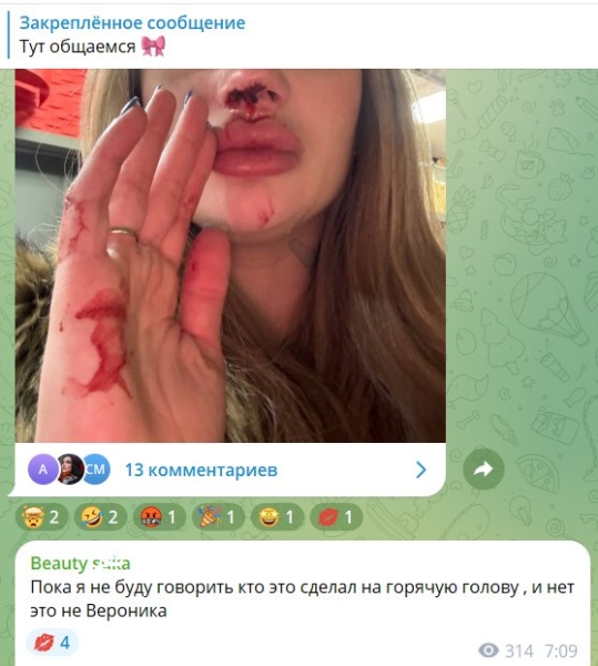 Ксения Карпова попала под горячую руку и получила в нос Ксения Карпова попала под горячую руку и получила в нос