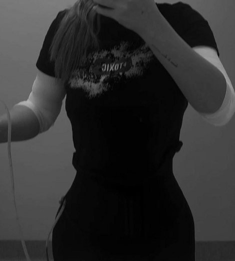 Екатерина Горина показала результат после повторного липомоделирования Екатерина Горина показала результат после повторного липомоделирования