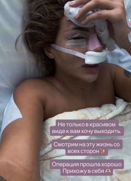 Виктория Дилье сделала ринопластику Виктория Дилье сделала ринопластику