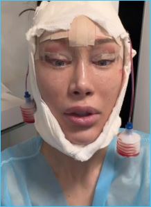 Алена Ашмарина довольна преображением своего лица Алена Ашмарина довольна преображением своего лица