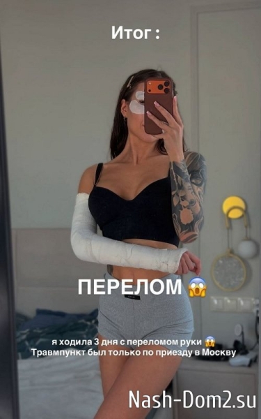 Алёна Савкина вернулась с Байкала без одной конечности Алёна Савкина вернулась с Байкала без одной конечности