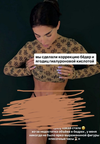 Зрители Дома 2 шокированы тем, что сделала с собой Катя Скалон Зрители Дома 2 шокированы тем, что сделала с собой Катя Скалон