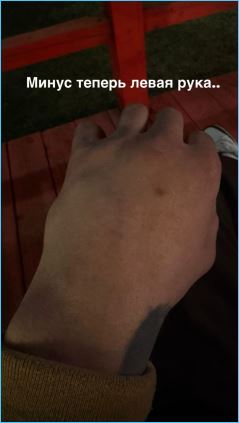 Владимир Балан опять получил травму Владимир Балан опять получил травму