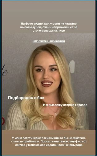 Милена Безбородова жалуется на заниженную самооценку Милена Безбородова жалуется на заниженную самооценку