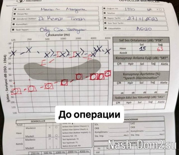 Рита Марсо: Вдруг начались какие-то щелчки в ухе Рита Марсо: Вдруг начались какие-то щелчки в ухе