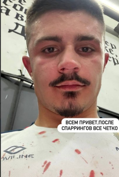 Никита Гуранда пострадал на подготовке к соревнованиям Никита Гуранда пострадал на подготовке к соревнованиям