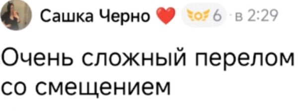 Саша Черно сломала ногу, катаясь на гироскутере Саша Черно сломала ногу, катаясь на гироскутере