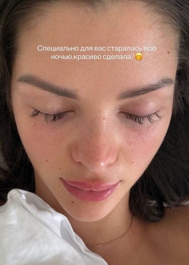 Подписчики поставили диагноз Анне Самониной Подписчики поставили диагноз Анне Самониной