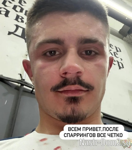 Никита Гуранда получил травму во время спарринга Никита Гуранда получил травму во время спарринга