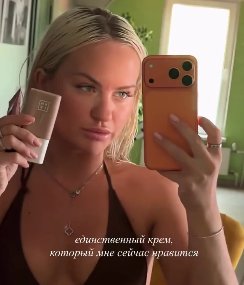 Элина Рахимова озабочена новыми проблемами с кожей Элина Рахимова озабочена новыми проблемами с кожей