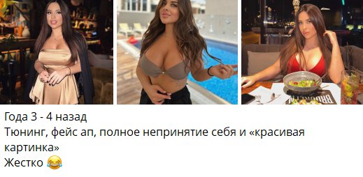 Евгения Хорошева не принимала себя, пока не сделала операции Евгения Хорошева не принимала себя, пока не сделала операции