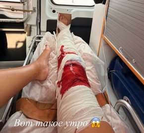 Ольгу Бузову госпитализировали из-за травмы колена Ольгу Бузову госпитализировали из-за травмы колена