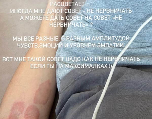 Анна Седокова пожаловалась на проблемы со здоровьем Анна Седокова пожаловалась на проблемы со здоровьем