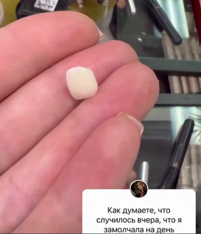 У Нади Ермаковой случилась новая неприятность У Нади Ермаковой случилась новая неприятность